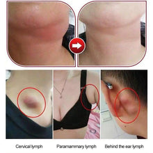 Load image into Gallery viewer, Herbal Lymph Care Patch