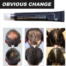 Load image into Gallery viewer, Roll-on Hair Growth Serum