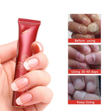 Load image into Gallery viewer, Nail Repair Cream