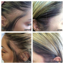 Load image into Gallery viewer, Roll-on Hair Growth Serum