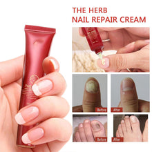 Load image into Gallery viewer, Nail Repair Cream
